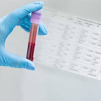 Test tube for laboratory diagnostics