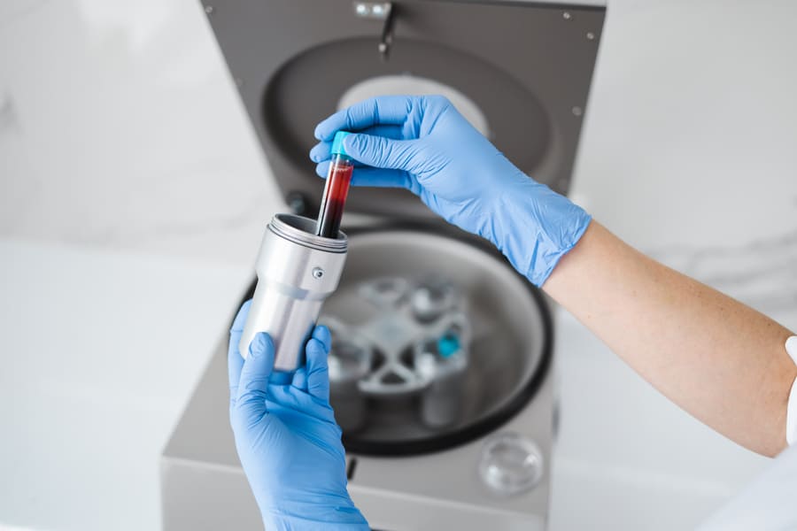 PBMC isolation at Medicover Integrated Clinical Services