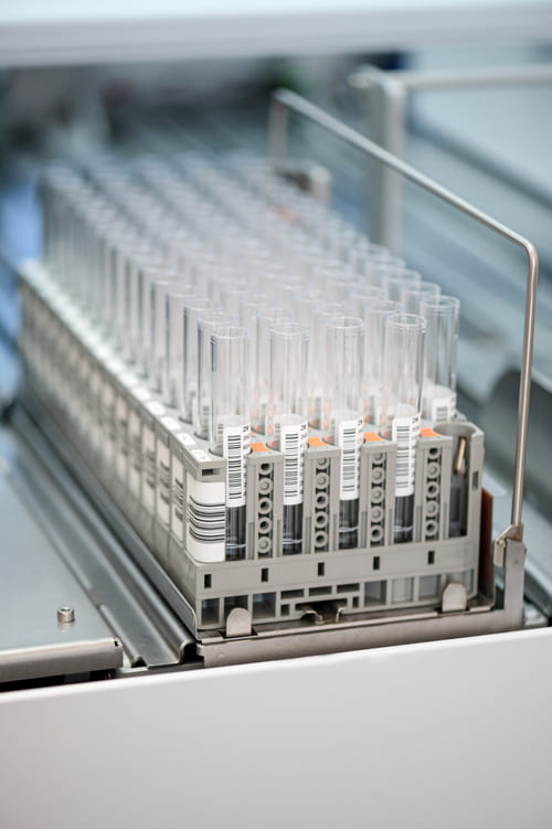 Biomarker Development