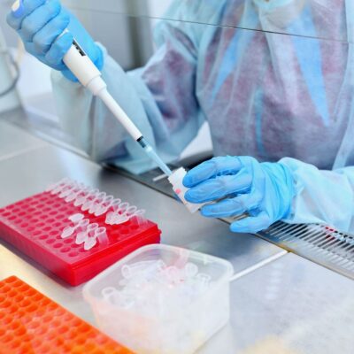 Central Lab vs Local Laboratories in Clinical Trials: Which Model to Choose and When